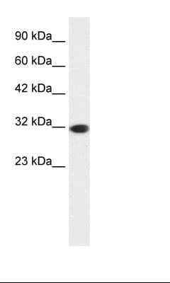 Polyclonal Rabbit anti-Human EMX2 Antibody (N-Terminus, IHC, WB)