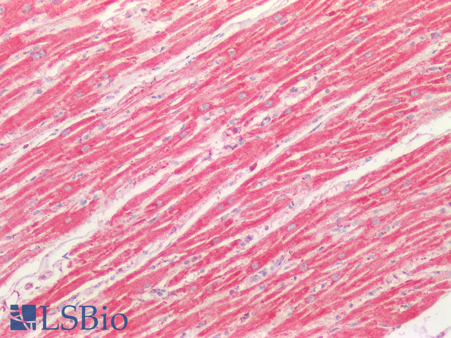 PathPlus™ SOD2 / Mn SOD Antibody (aa77-91)