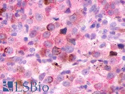 PathPlus™ XCR1 Antibody (Extracellular Domain)