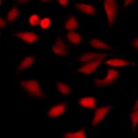 NAA10 / ARD1A Antibody