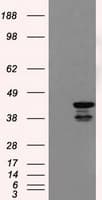 DAPK2 / DAP Kinase 2 Antibody (clone OTI1F7, Carrier-free)