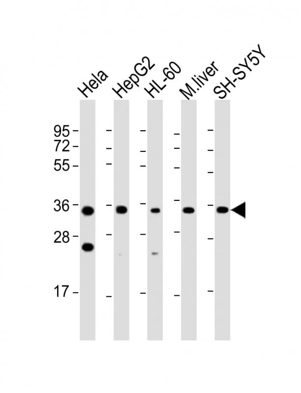 Polyclonal Rabbit anti-Human ADORA3 / Adenosine A3 Receptor Antibody (aa202-232, WB)