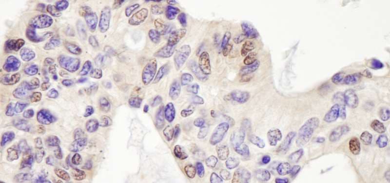 USP28 Antibody (aa50-100)