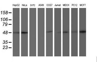 AIPL1 Antibody (clone OTI2B11)