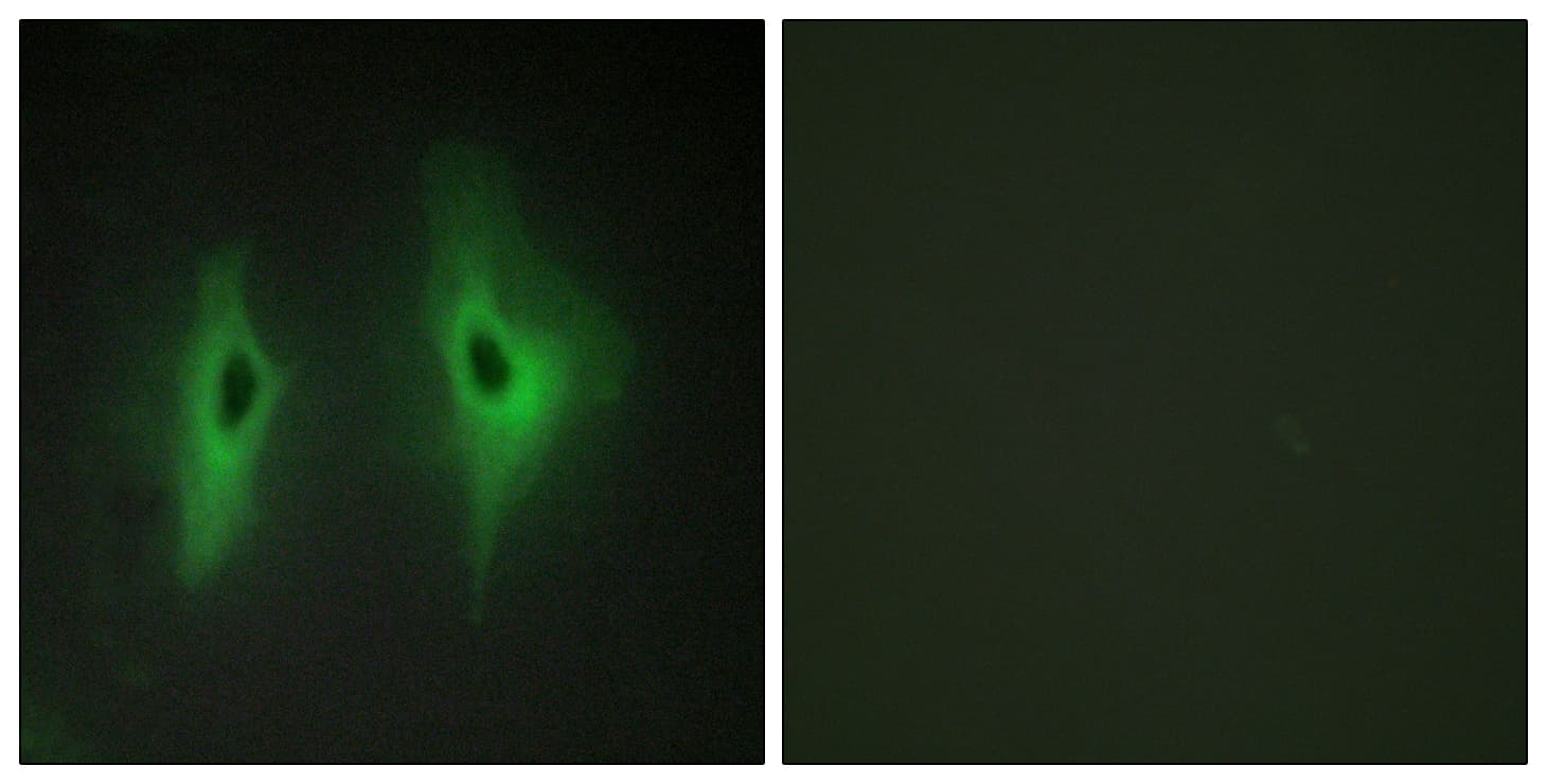 DGKeta / DGKH Antibody (aa771-820)