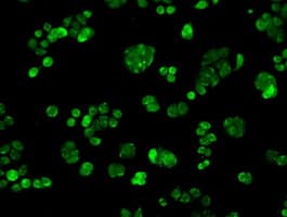 CYPOR / POR Antibody (clone OTI5H5)
