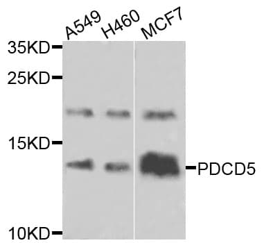 PDCD5 Antibody