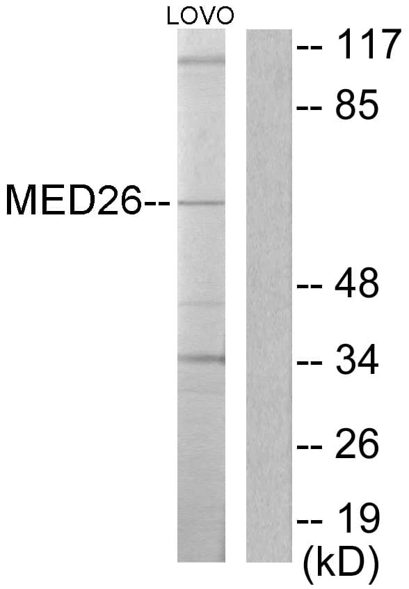 MED26 / CRSP7 Antibody (aa1-50)