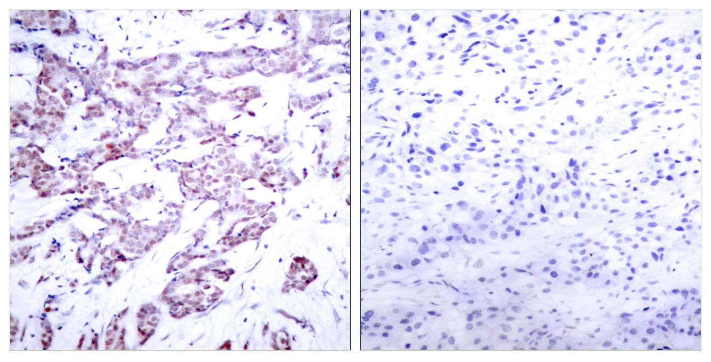 STAT6 Antibody (phospho-Thr645)
