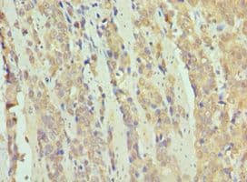 Polyclonal Rabbit anti-Human SMARCB1 / INI1 Antibody (aa86-385, IHC, WB)