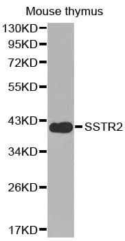 Polyclonal Rabbit anti-Human SSTR2 Antibody (IHC, WB)