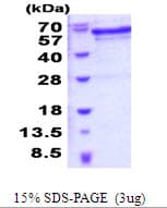 Human JMJD6 / PSR Protein (Recombinant His)