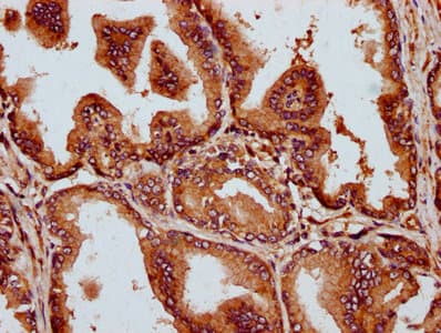 Polyclonal Rabbit anti-Human MCTP2 Antibody (IHC, IF)