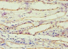 AKR1B10 Antibody (aa1-316)