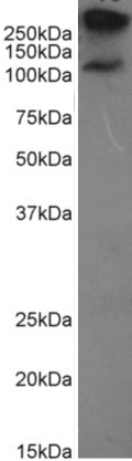 Recombinant Monoclonal Rabbit anti-Human EMA / MUC1 Antibody (clone HMFG2, MUC1, IHC)