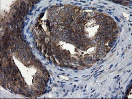 CNOT4 / CLONE243 Antibody (clone OTI1H2)