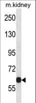 KCNC2 / Kv3.2 Antibody (aa544-573)