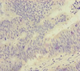 FOXRED1 Antibody
