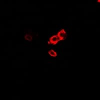 OGT / O-GLCNAC Antibody