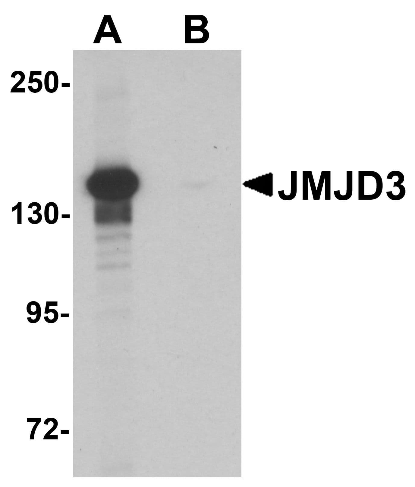 Polyclonal Rabbit anti-Human KDM6B / JMJD3 Antibody (IF, WB)