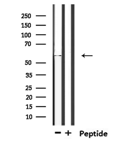 TIGD4 Antibody