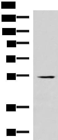 IRX1 Antibody