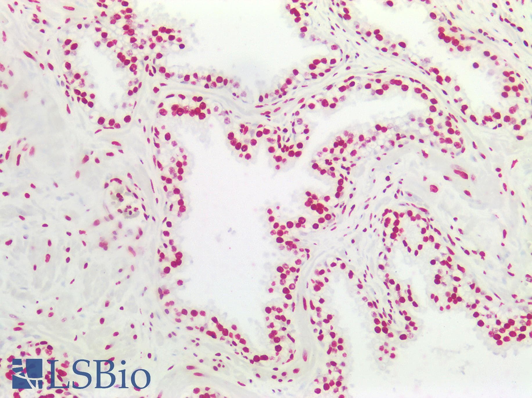 PathPlus™ HES5 Antibody