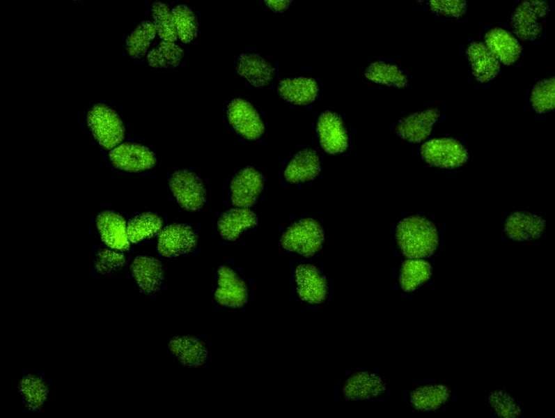 IHC-plus™ Polyclonal Rabbit anti-Human TRIM28 / KAP1 Antibody (aa1-50, IHC, IF)