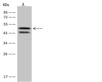 Polyclonal Rabbit anti-Human SYT11 Antibody (IHC, WB)