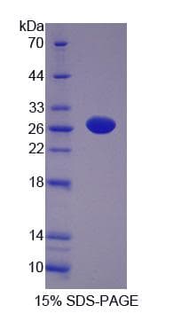 Rat NT5M Protein (Recombinant)