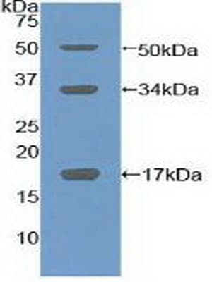 Collagen X Antibody (aa547-680)