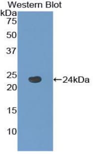 TACR2 / NK2R Antibody (aa92-290)