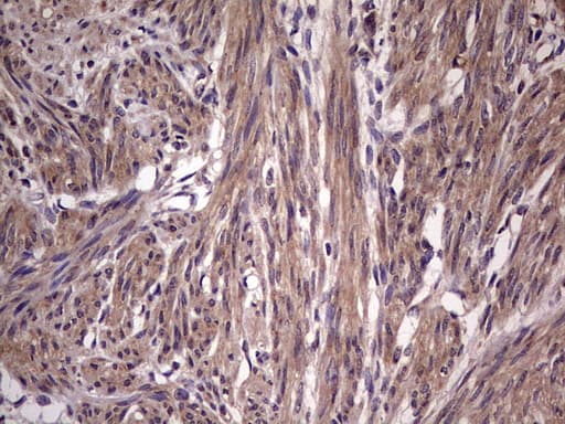 Monoclonal Mouse anti-Human BFSP2 Antibody (clone OTI4E7, aa184-415, IHC, WB)