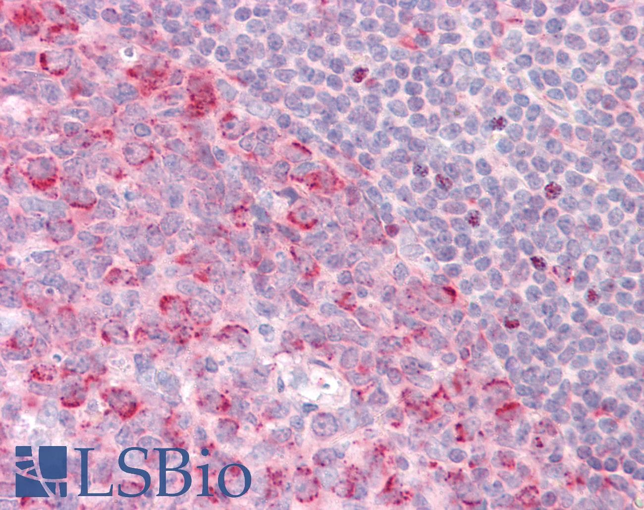 IHC-plus™ PELI1 / Pellino 1 Antibody