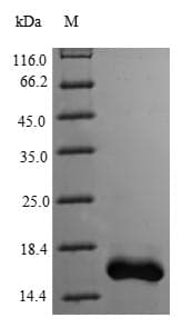 Human PCBD1 / PHS Protein (Recombinant 6His, N-terminus)