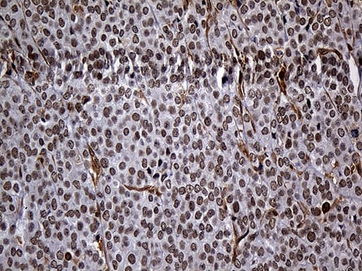 RAD21 Antibody (aa193-458, clone OTI6C10, Carrier-free)