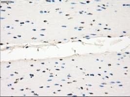 MAP2K1 / MKK1 / MEK1 Antibody (clone OTI1F5)