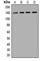 VARS / ValRS Antibody