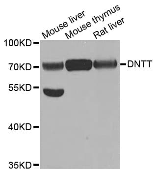 DNTT / TdT Antibody