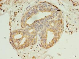 KRT8 / CK8 / Cytokeratin 8 Antibody (aa19-148, FITC)