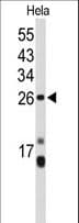 IHC-plus™ CENPH / CENP-H Antibody (aa136-162)