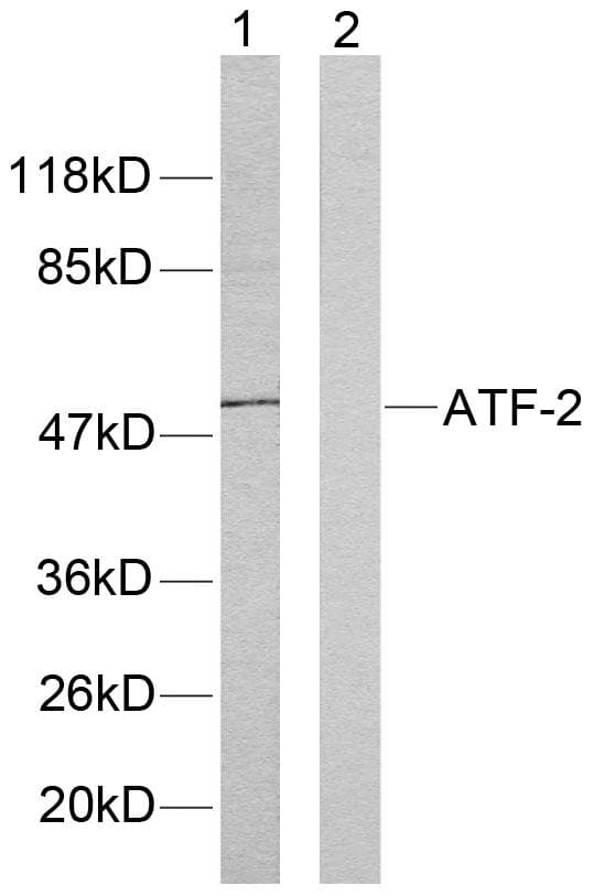 ATF2 Antibody (p71 or 53)