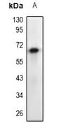 Polyclonal Rabbit anti-Human EPOR / EPO Receptor Antibody (WB)