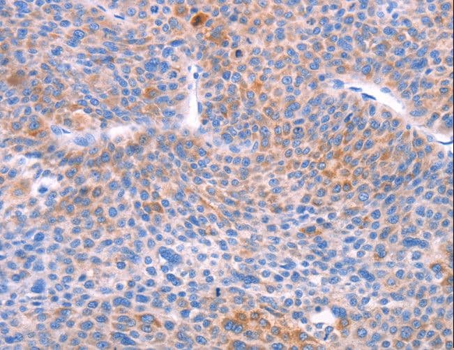 Polyclonal Rabbit anti-Human AADAC Antibody (IHC, WB)