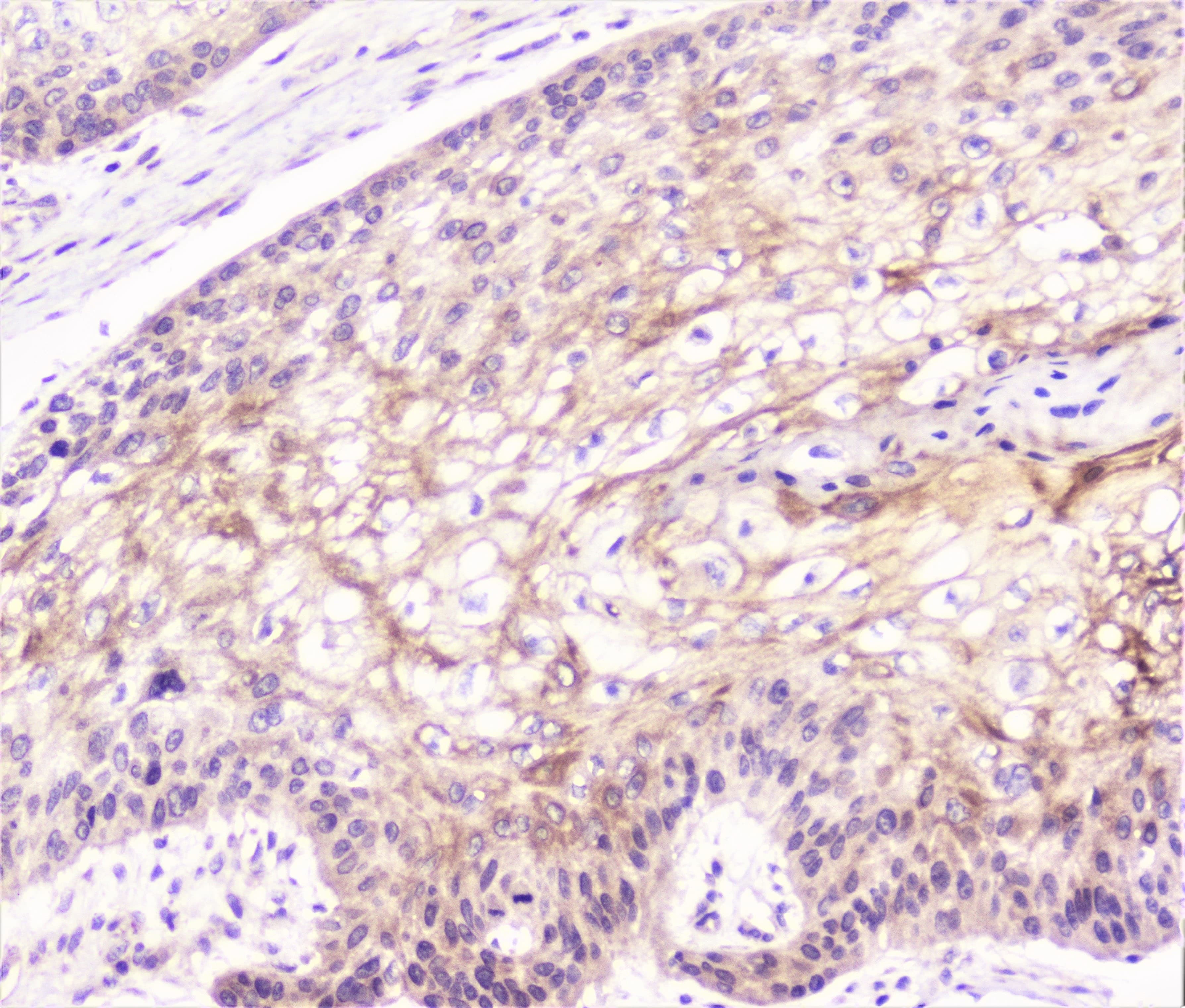 COMP / THBS5 Antibody