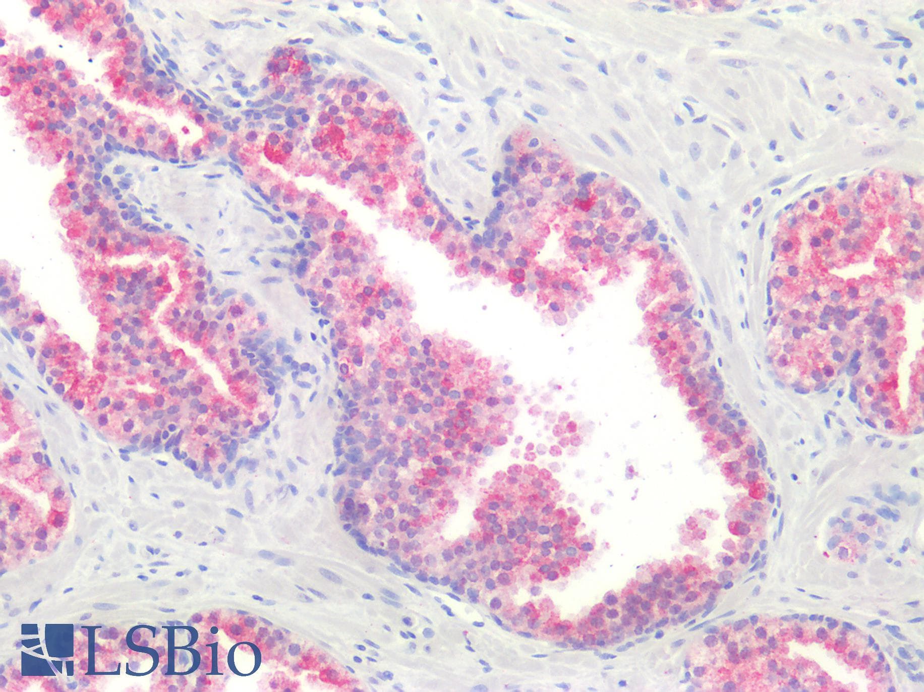 PathPlus™ GPR87 Antibody (N-Terminus)