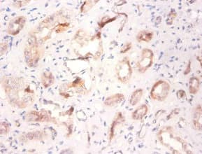 Polyclonal Rabbit anti-Human ATP6V1F Antibody (WB)