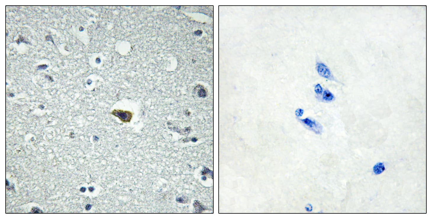Polyclonal Rabbit anti-Human ADGRB1 / BAI1 Antibody (aa691-740, IHC, IF, WB)