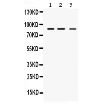 Polyclonal Rabbit anti-Human Pyrin / MEFV / MEF Antibody (aa5-39, WB)