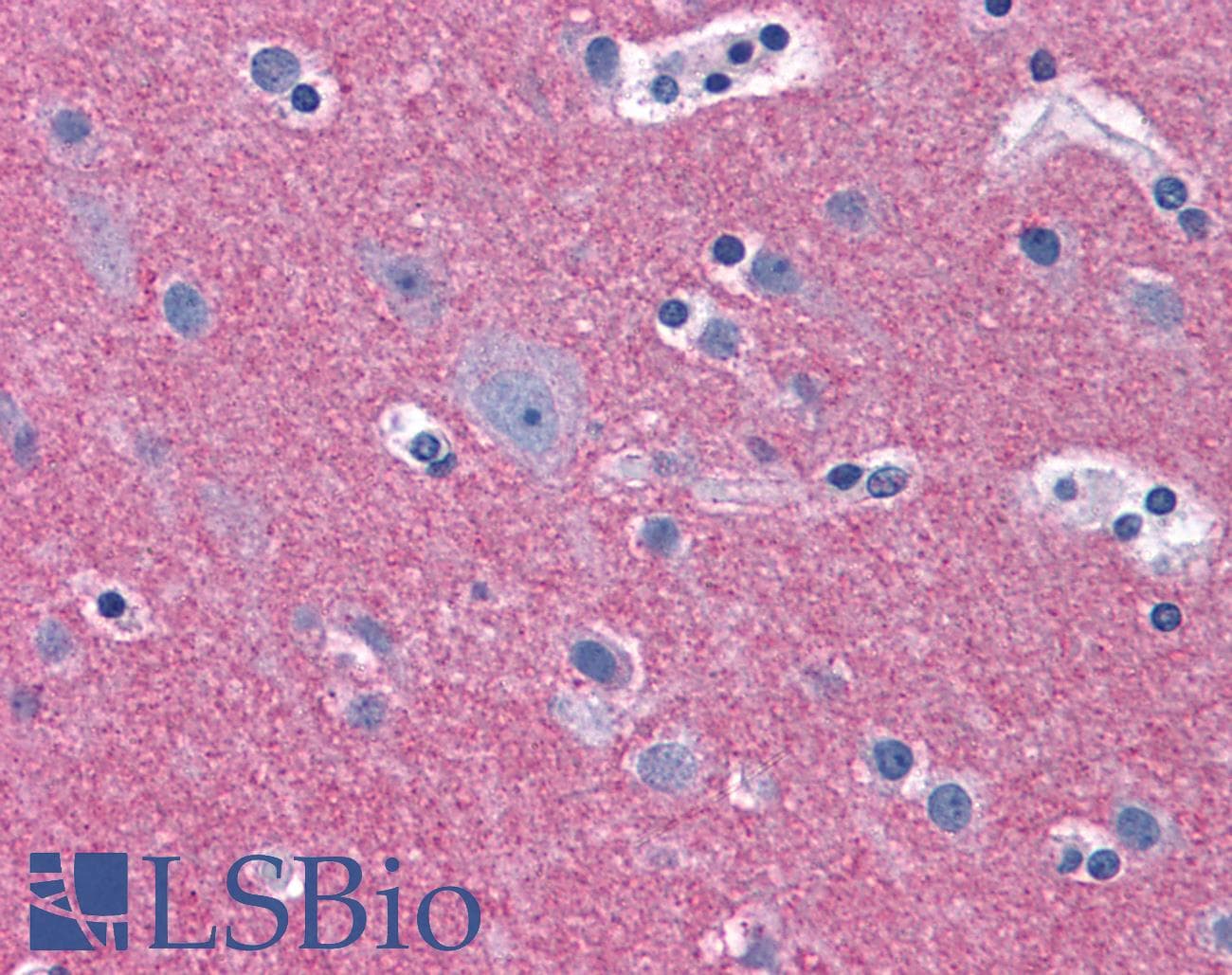 IHC-plus™ RIMS2 / RIM2 Antibody